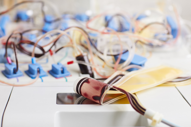 Why-Hire-an-Electrical-Engineer-Expert-Witness-for-Your-Next-Case-02